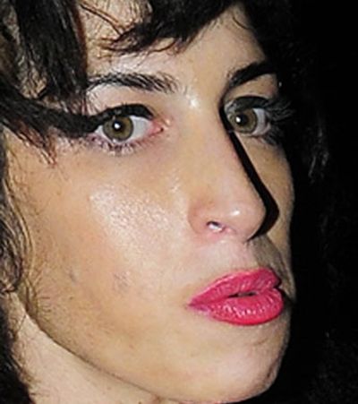 Amy confessed to a magazine that her drug use was the reason for her hospitalisation, saying "I really thought that it was over for me then."