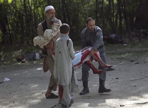 A severely injured woman is helped from the scene. Picture: AAP