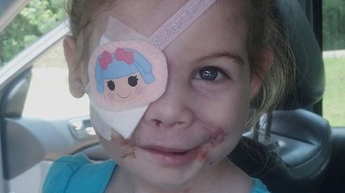 Family of disfigured girl reject KFC donation