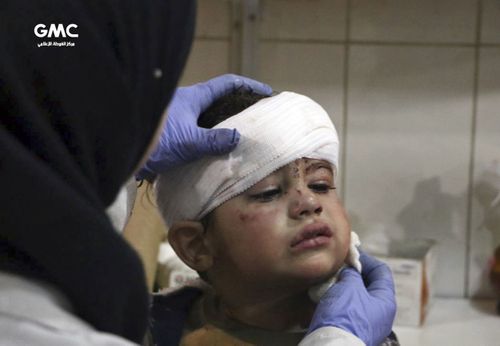 An  injured boy receives treatment at a hospital in Hazeh in eastern Ghouta.  (Ghouta Media Center via AP)
