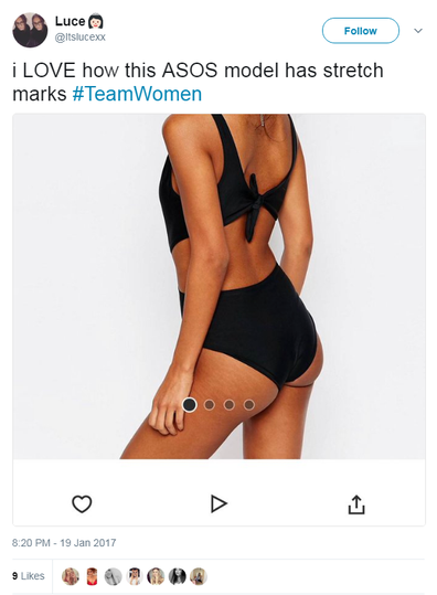 ASOS Showcases Models' Stretch Marks in Unedited Photos