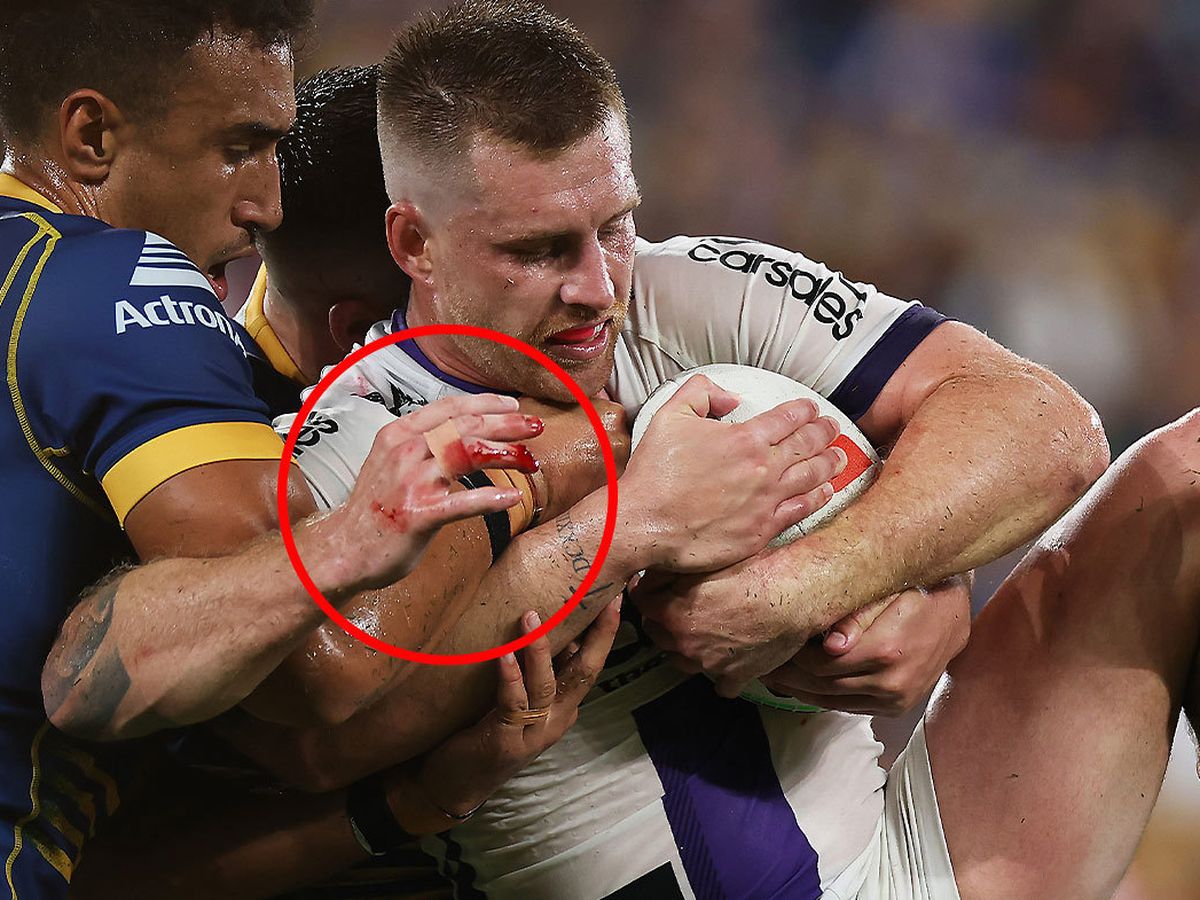 NRL Injury List  NRL Team Injuries for the 2023 Season - KRUZEY