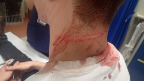 The teenager was struck on the back of the head with a glass bottle after removing his helmet. (WA Police)