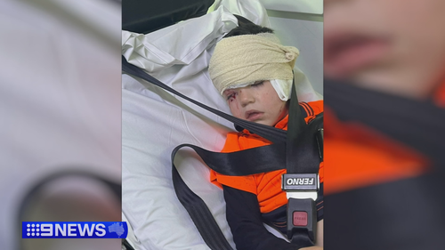 Perth mum's 'living nightmare' after four-year-old attacked by dog