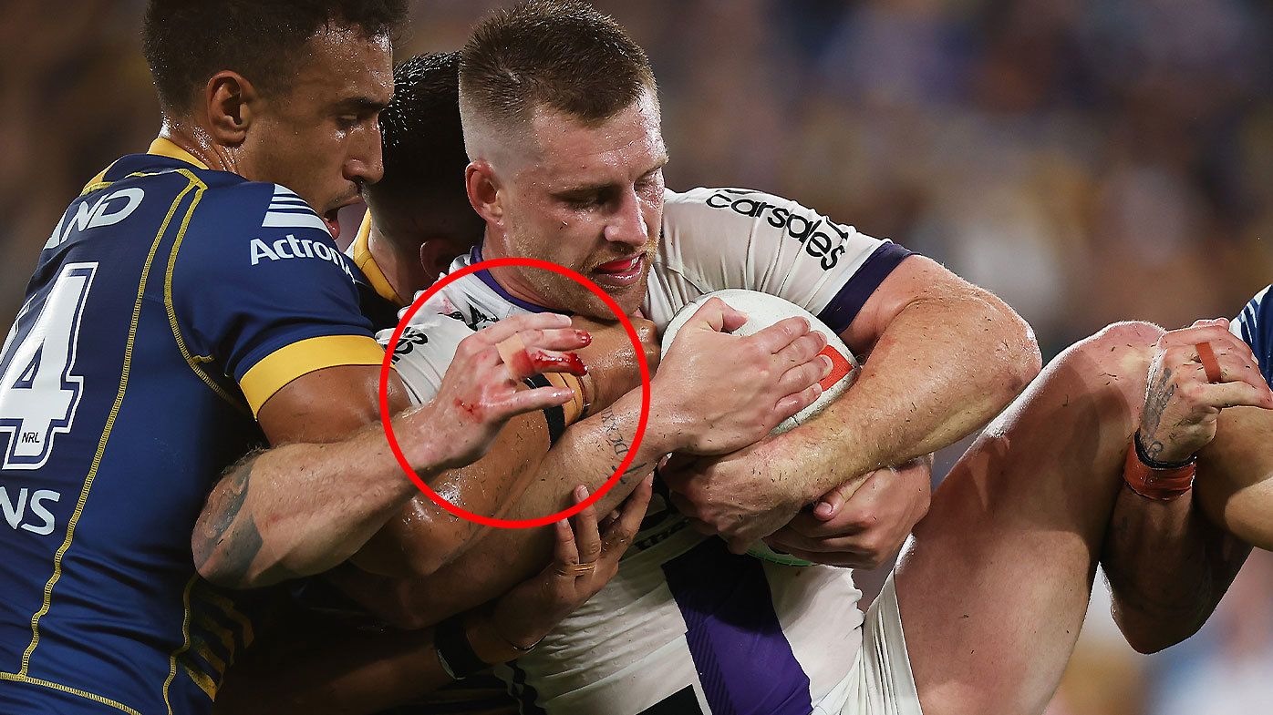 Cameron Munster&#x27;s right hand was left bloodied after suffering a compound dislocation during the first half