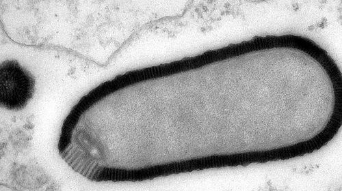 Giant 30,000-year-old virus comes back to life