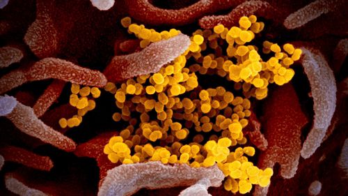 Microscope image shows the Novel Coronavirus SARS-CoV-2 (yellow) emerging from the surface of cells.