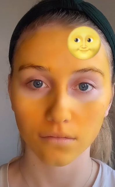 Woman's home face mask remedy dyes her skin bright yellow