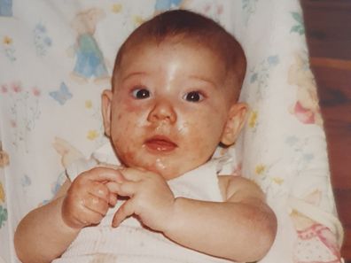 Rhiannon Grant has lived with severe allergies all her life and is now an allergy researcher.