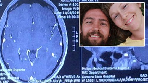 Joel North and Anita with MRI scan