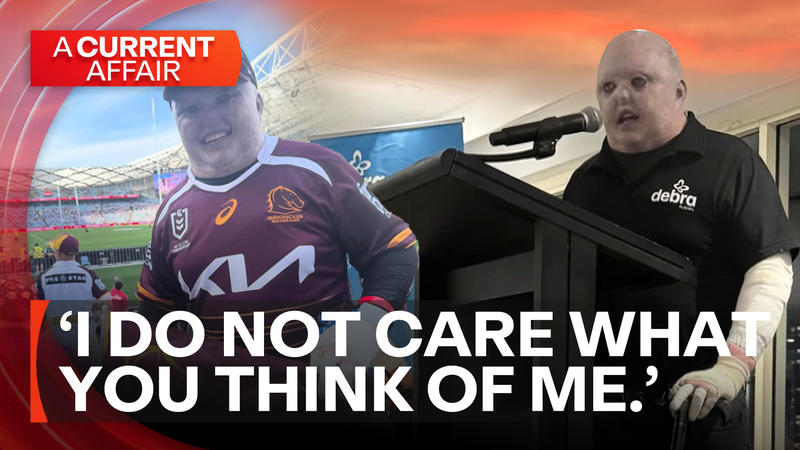 Dean’s message to online bullies | Nine.com.au