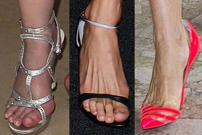These celebs may have high-fash wardrobes, enviable careers and enough money to buy a small island, BUT when it comes to their feet we're not so jealous. <br/><br/>From bunions to bunged toes, guess whose got the worst tootsies in Tinsletown? <br/><br/>