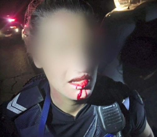 The officer was left with facial injuries after being bashed. (Supplied)