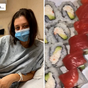 Woman ends up in hospital after eating too much sushi at an all-you-can eat buffet