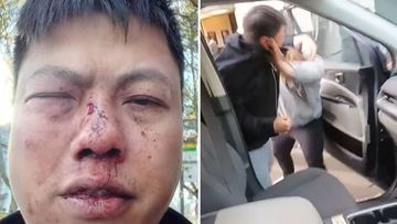 Melbourne father Tony Bui has been attacked after he confronted a man who allegedly stole his new car from his driveway. Tony Bui brought his brand new Kia Carnival home to his Footscray property on Friday afternoon. 