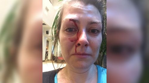 Erica Maloney was punched in the face in a random attack.