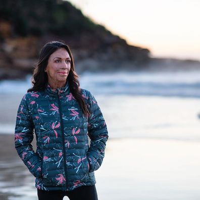 Turia Pitt was horrifically burned whilst competing in an ultra-marathon in 2011