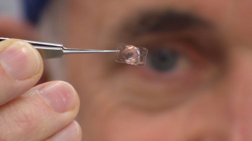 It's hoped the artificial lens will improve sight after cataract surgery. Picture: 9NEWS