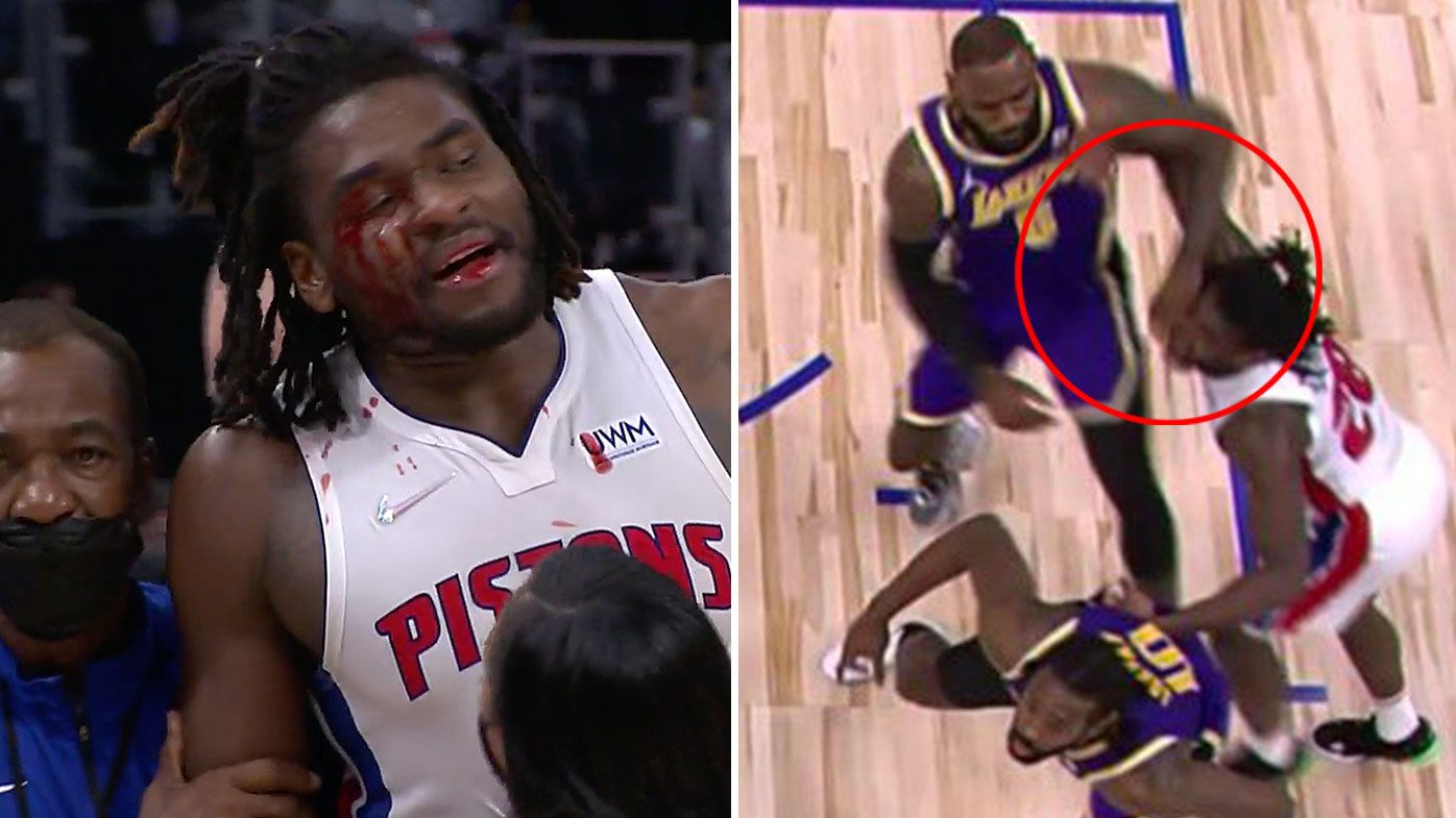 LeBron James, Isaiah Stewart ejected as 'bloody' NBA brawl breaks out during Lakers-Pistons clash