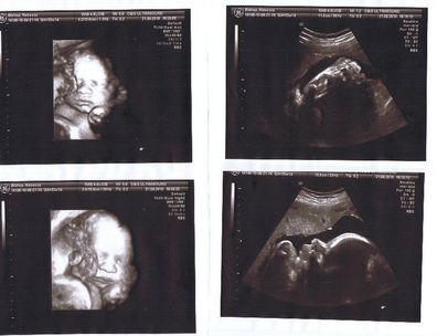 Ultrasounds revealed Bek Bishop's son was healthy.