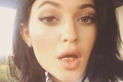 Which other 17-year-old girl can afford a mouth full of gold?<br/><br/>Although we're not fans of the golden grill, we're surprised that Kylie kind of pulls it off.
