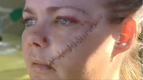 Ingrid Brown remembers 'a blade' coming towards her before the alleged attack. (9NEWS)