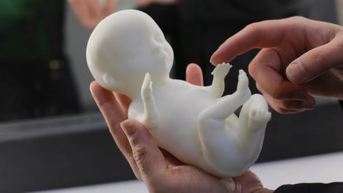 New technology allows the printing of 3D models of unborn children. (Rutly)