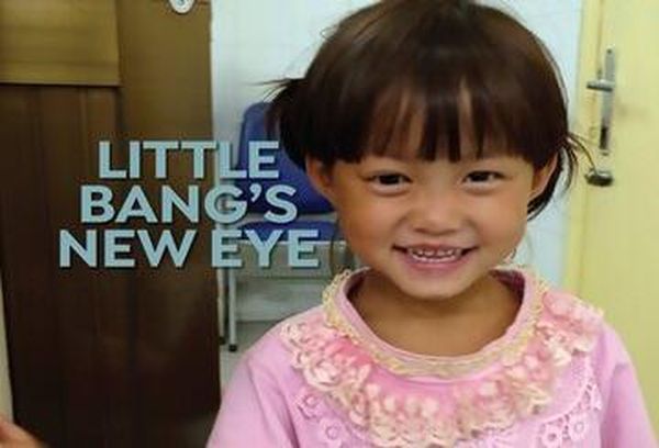 Little Bang's New Eye