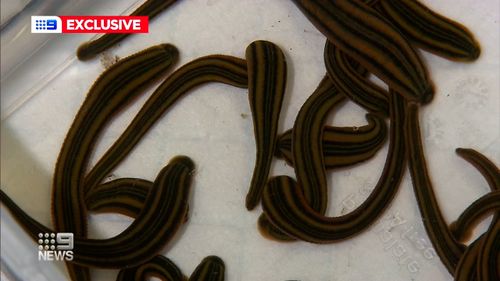 Twenty tiny leeches were then used to complete the treatment.