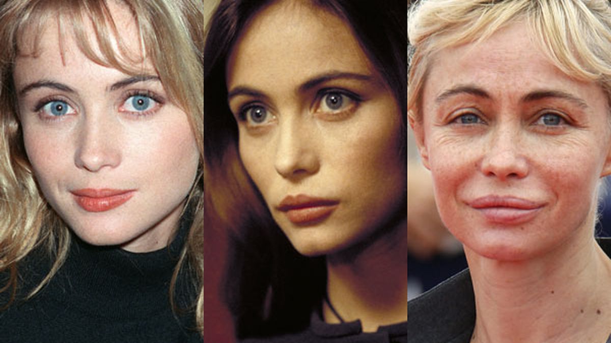 Emmanuelle beart plastic surgery