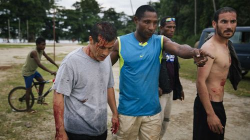 Following the PNG ruling in April, the men being held on Manus Island have been given limited rights to leave the centre. (Matthew Abbott/GetUp via AAP)