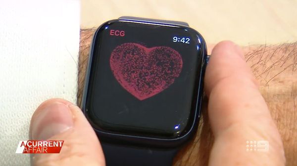 Apple Watch: Could Smart Watch Save Life From Heart Problems