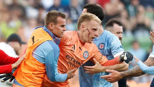 A bleeding Tom Glover of Melbourne City is escorted from the pitch by team mates after fans stormed the pitch during the round eight A-League Men's match between Melbourne City and Melbourne Victory at AAMI Park, on December 17, 2022, in Melbourne, Australia. (Photo by Darrian Traynor/Getty Images)