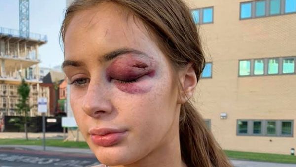 Teen attacked for turning down strangers' advances.
