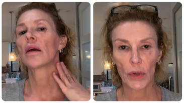 Brandi Glanville reveals several diagnoses amid health battle