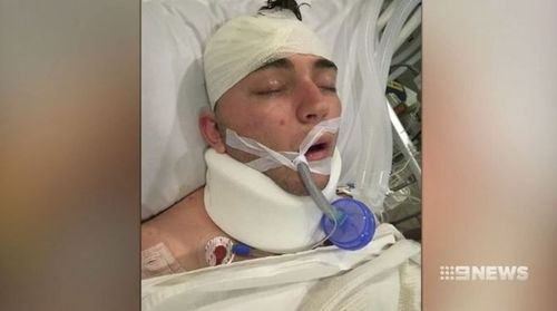 Mr Thomas suffered serious head injuries in the scooter crash. (9NEWS)