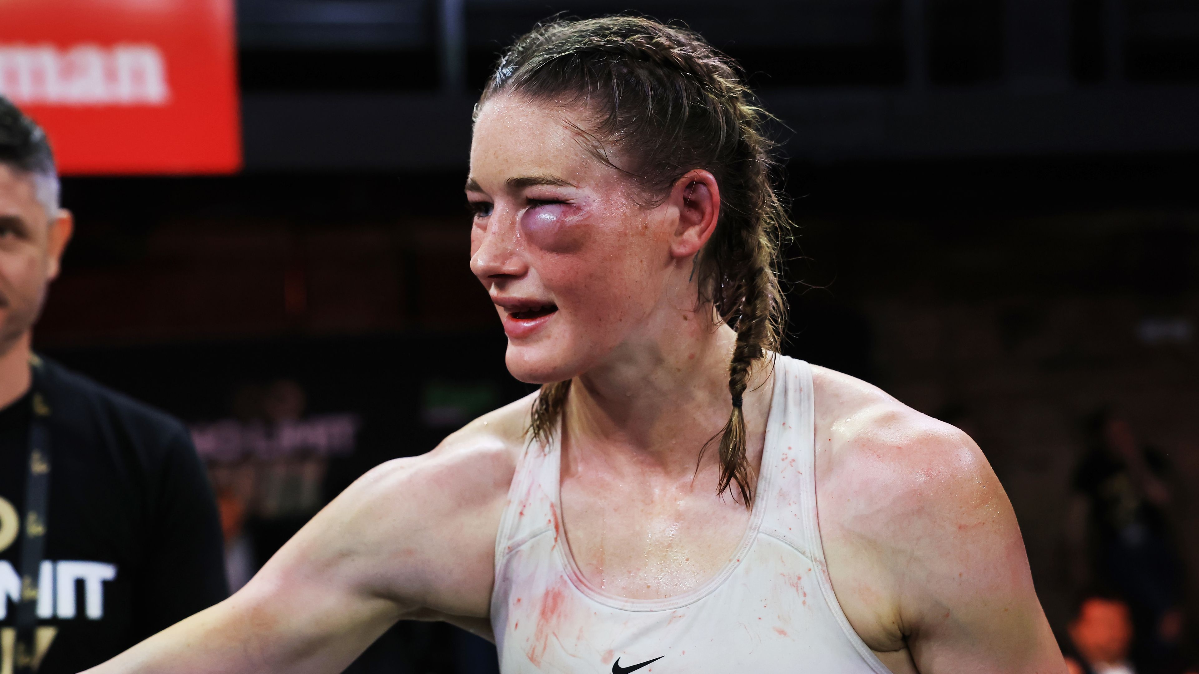 A bruised Tayla Harris after being beaten by Millicent Agboegbulen at Hoops Capital East.