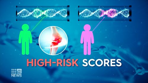 At least one in 11 Australians have osteoarthritis while the number of people needing joint replacements is growing. 