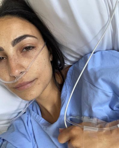 Tayla Damir Love Island Australia Endometriosis surgery symptoms