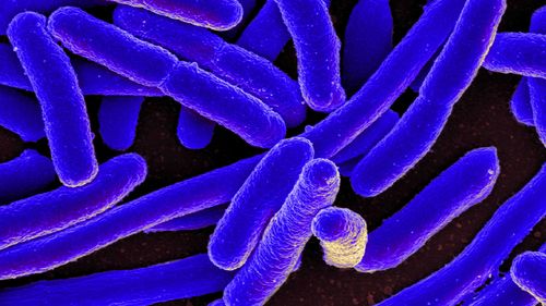 UTI's are caused when microorganisms such as bacteria enter the urethra or bladder. E. coli is a common bacteria involved.