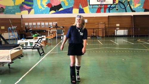 Anna Parsons is already walking again with her new prosthetic.