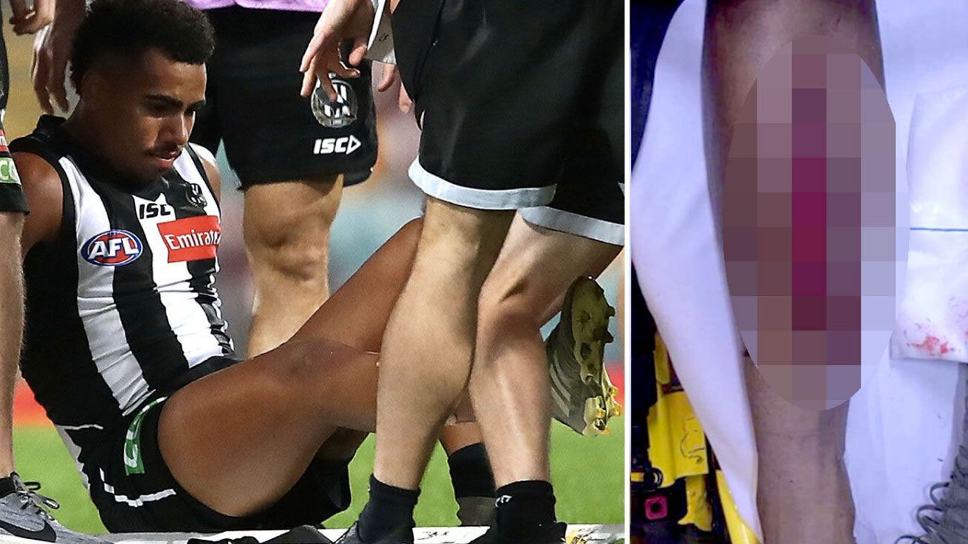 AFL to investigate Swans youngster's boots after 'hybrid' studs leave Magpie with gruesome injury