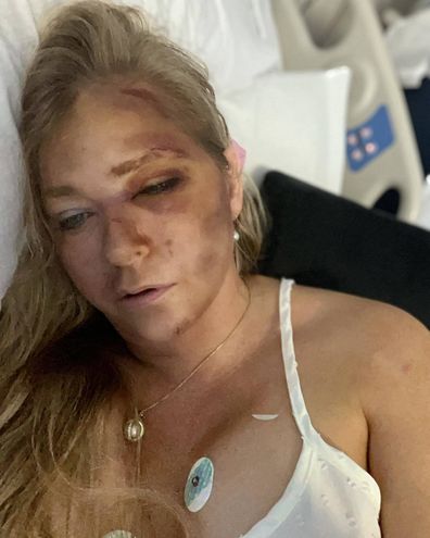Virginia Roberts Giuffre claims she has only days to live after suffering injuries in a bus crash in Western Australia, April 1 2025.